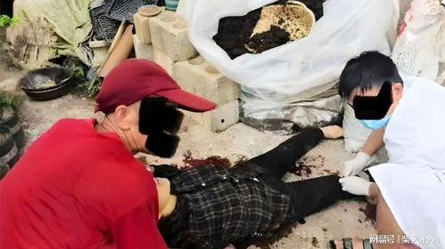 截肢视频,技术革新与患者康复之路