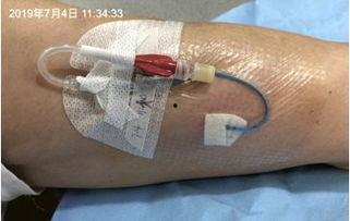 最新picc换药视频,专业指导，轻松掌握